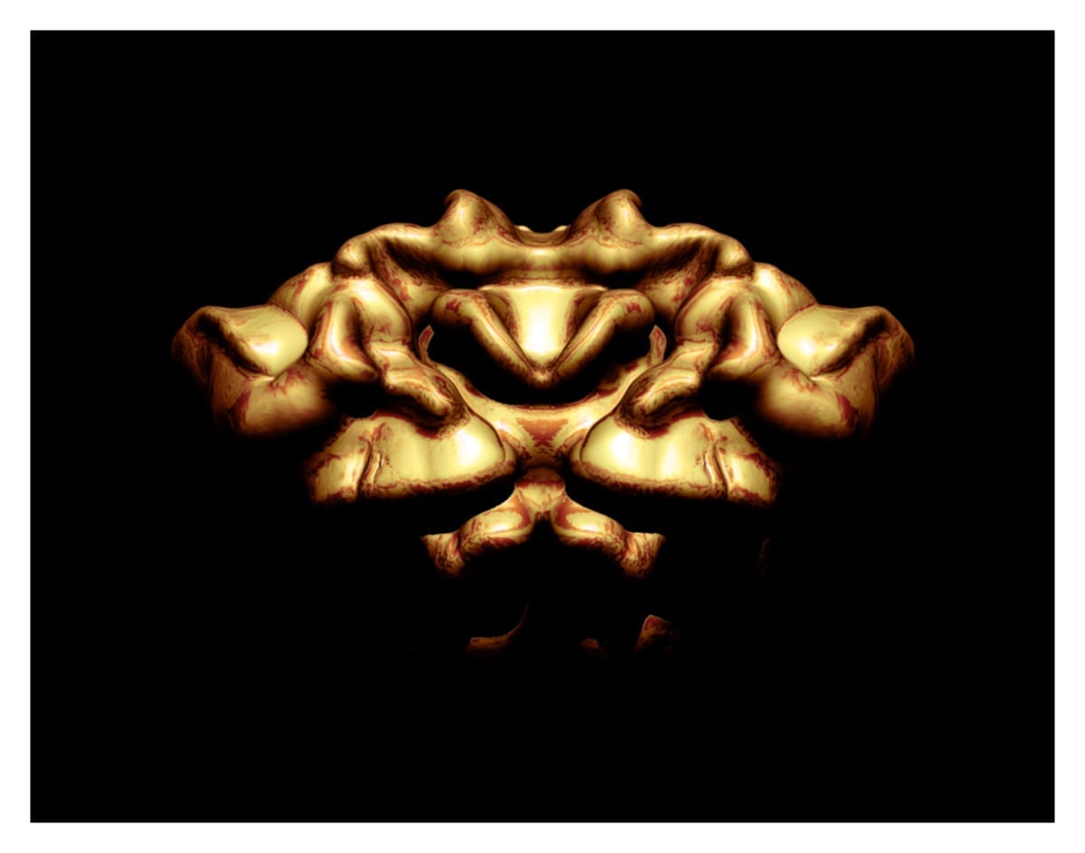 TorqPelvisFlesh